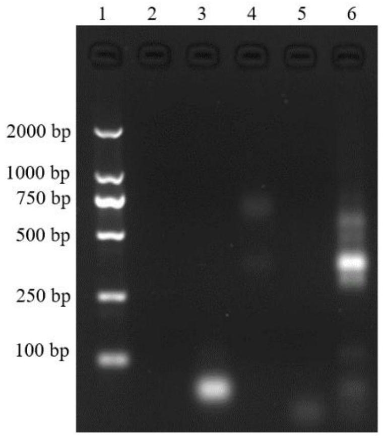 A self-assembled nucleic acid aptamer/protein composite nanoprobe, preparation method, kit and application thereof