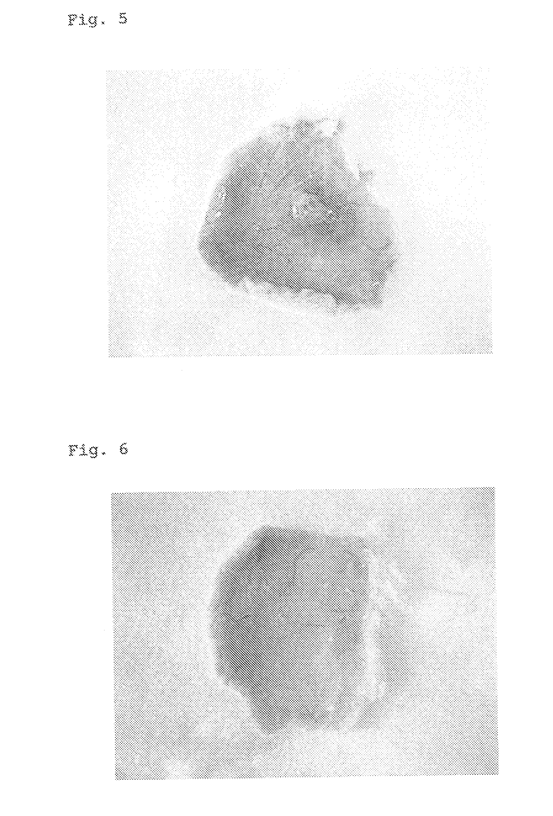 Method of controlling paticle size of retinoic acid nanoparticles coated with polyvalent metal inorganic salt and nanoparticles obtained by the controlling method