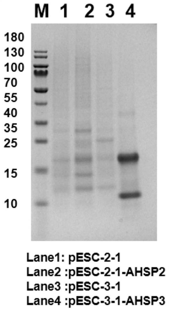 Construction and application of saccharomyces cerevisiae strain for efficiently synthesizing hemoglobin or myoglobin from different sources