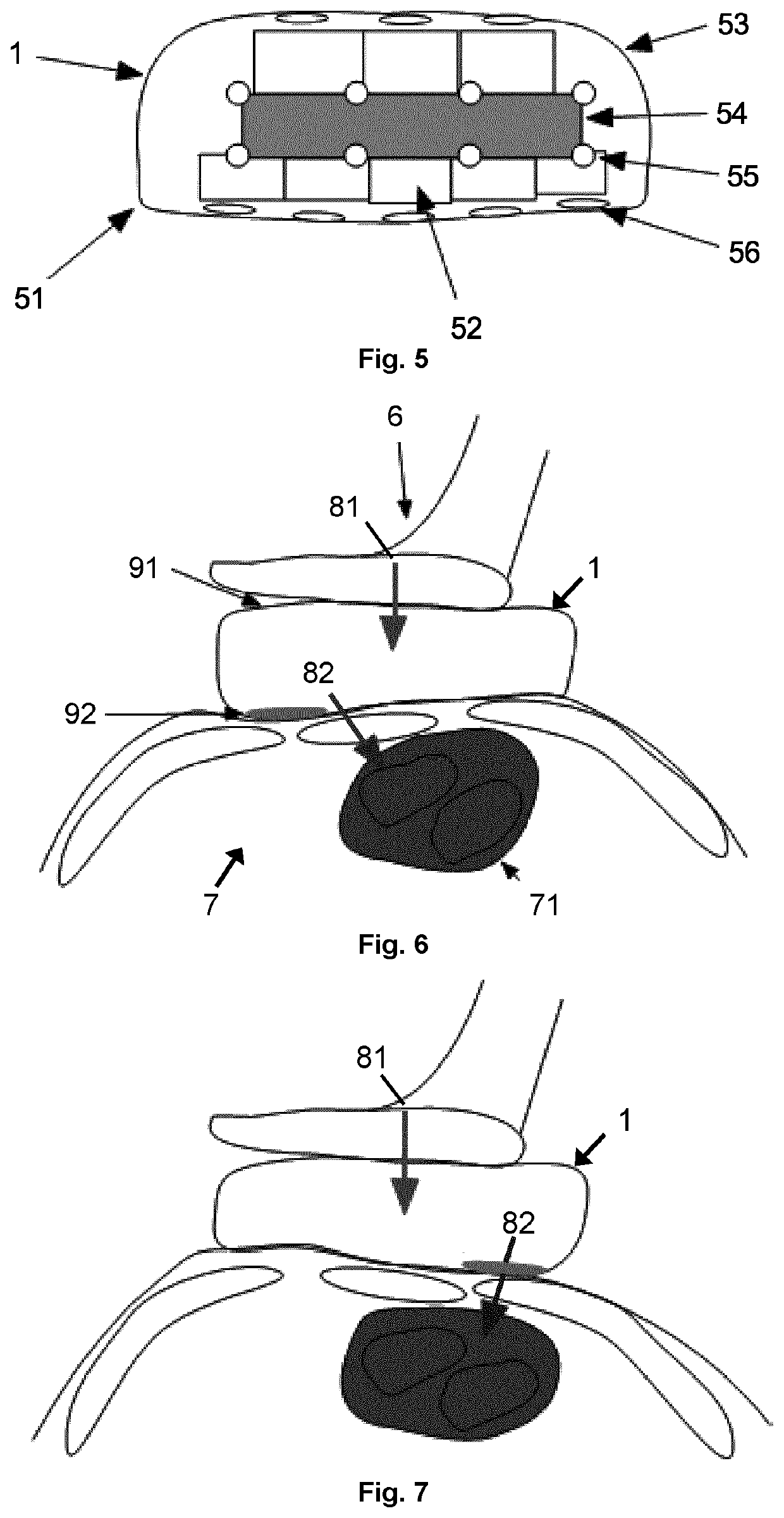 Cardiopulmonary resuscitation device, control method and computer program