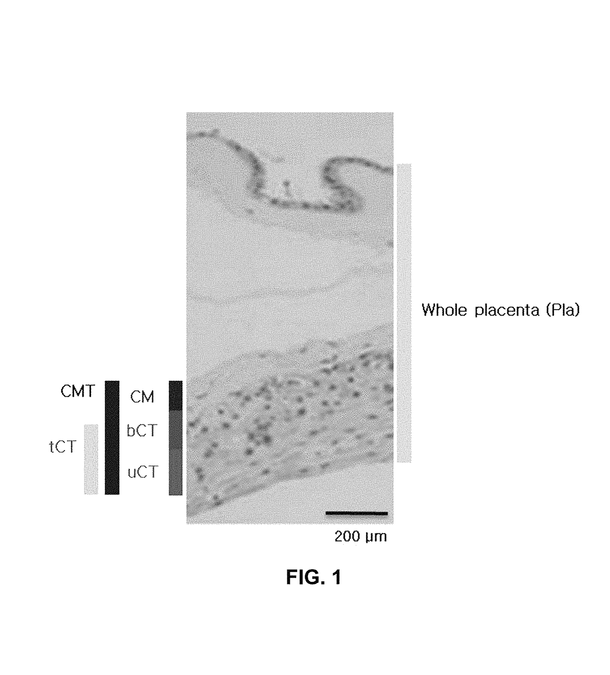 Stem cells derived from basal portion of chorionic trophoblast layer and cell therapy comprising same