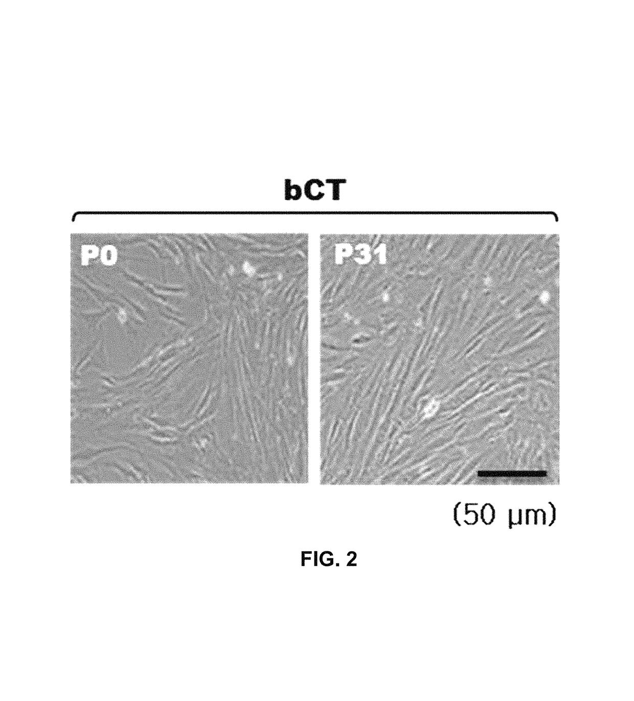 Stem cells derived from basal portion of chorionic trophoblast layer and cell therapy comprising same