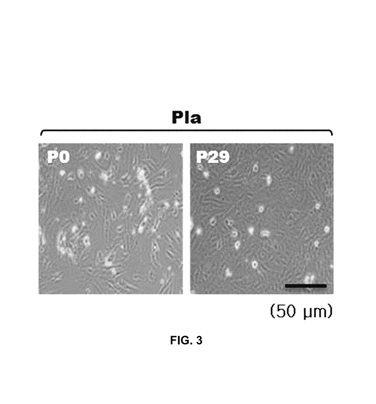 Stem cells derived from basal portion of chorionic trophoblast layer and cell therapy comprising same