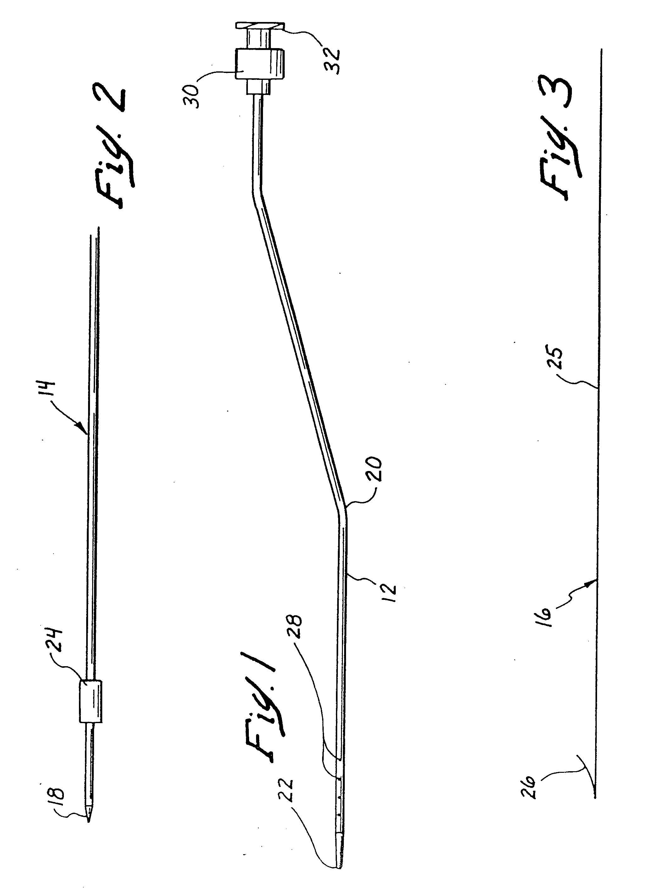 Methods and apparatus for securing medical instruments to desired locations in a patient's body