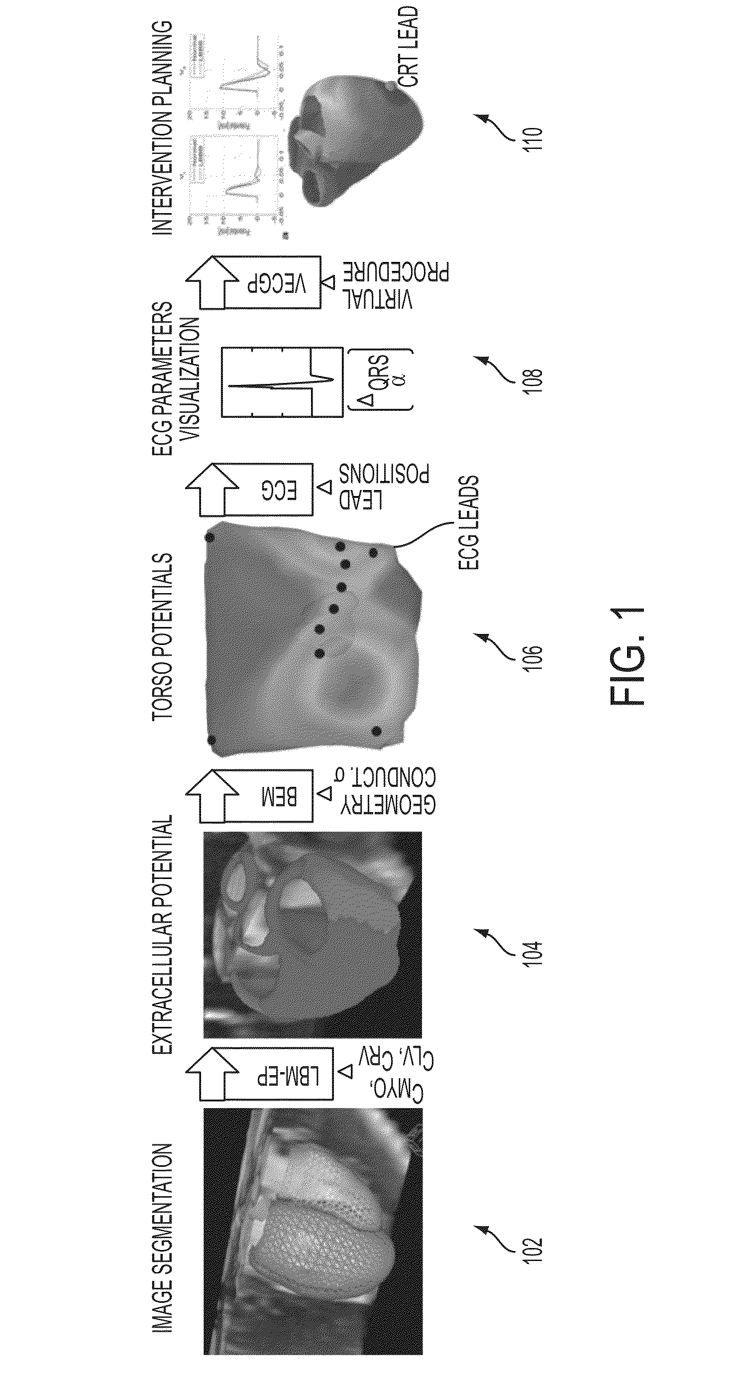 System and Method for Patient Specific Planning and Guidance of Electrophysiology Interventions