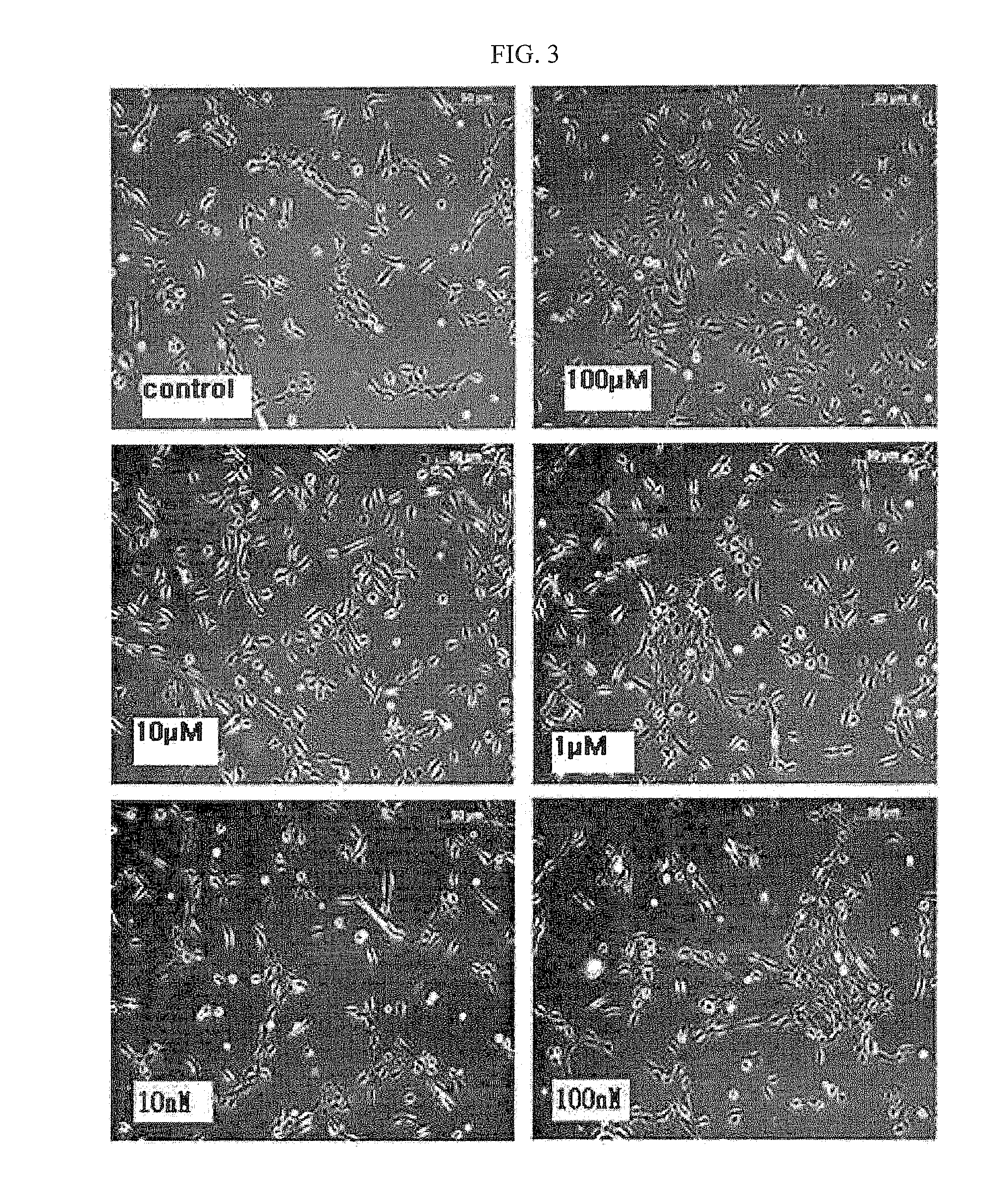 Method for isolating and culturing adult stem cells derived from human amniotic epithelium