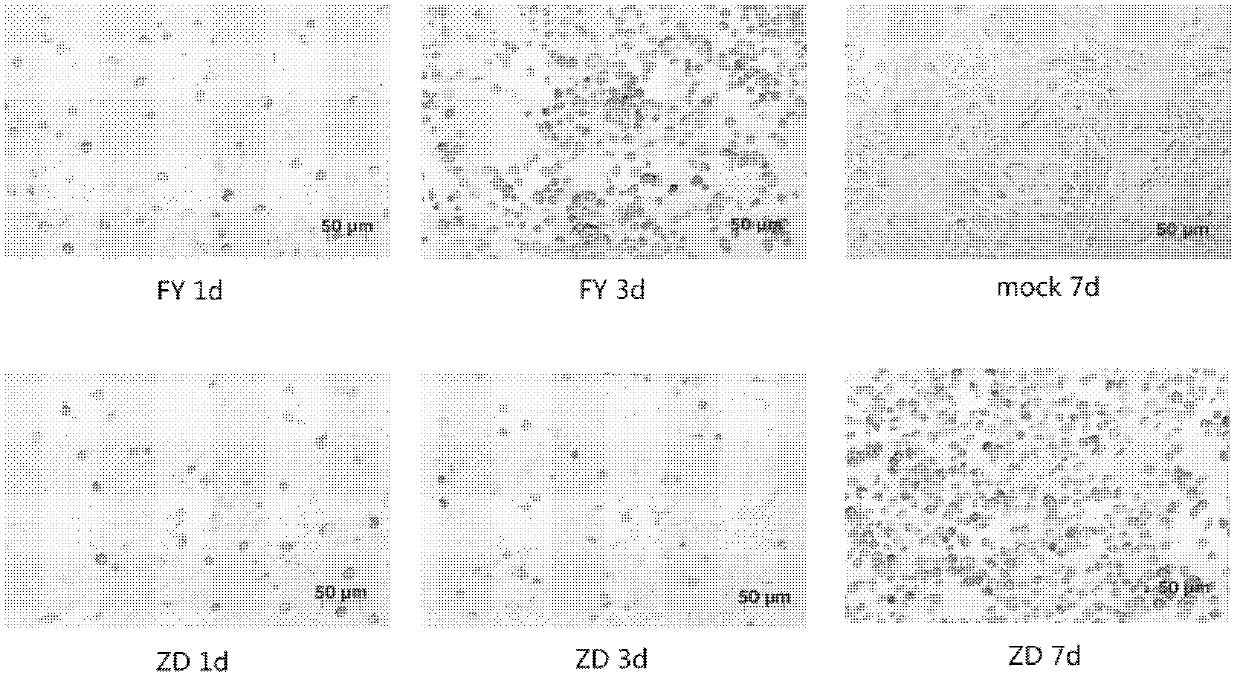 Enterovirus 71 (EV 71) Fuyang strain and cDNA (deoxyribonucleic acid) infectious clone of attenuated strain of enterovirus 71 (EV 71) Fuyang strain as well as application of enterovirus 71 (EV 71) Fuyang strain