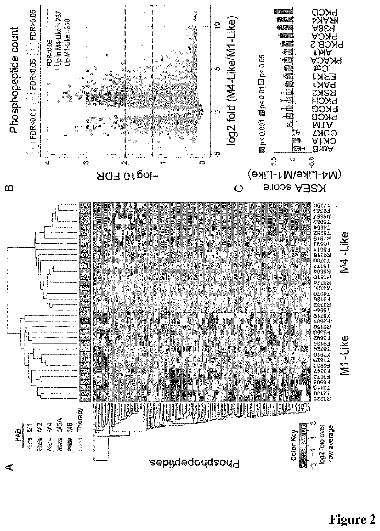 Stratification Of Acute Myeloid Leukaemia Patients For Sensitivity To Kinase Pathway Inhibitor Therapy