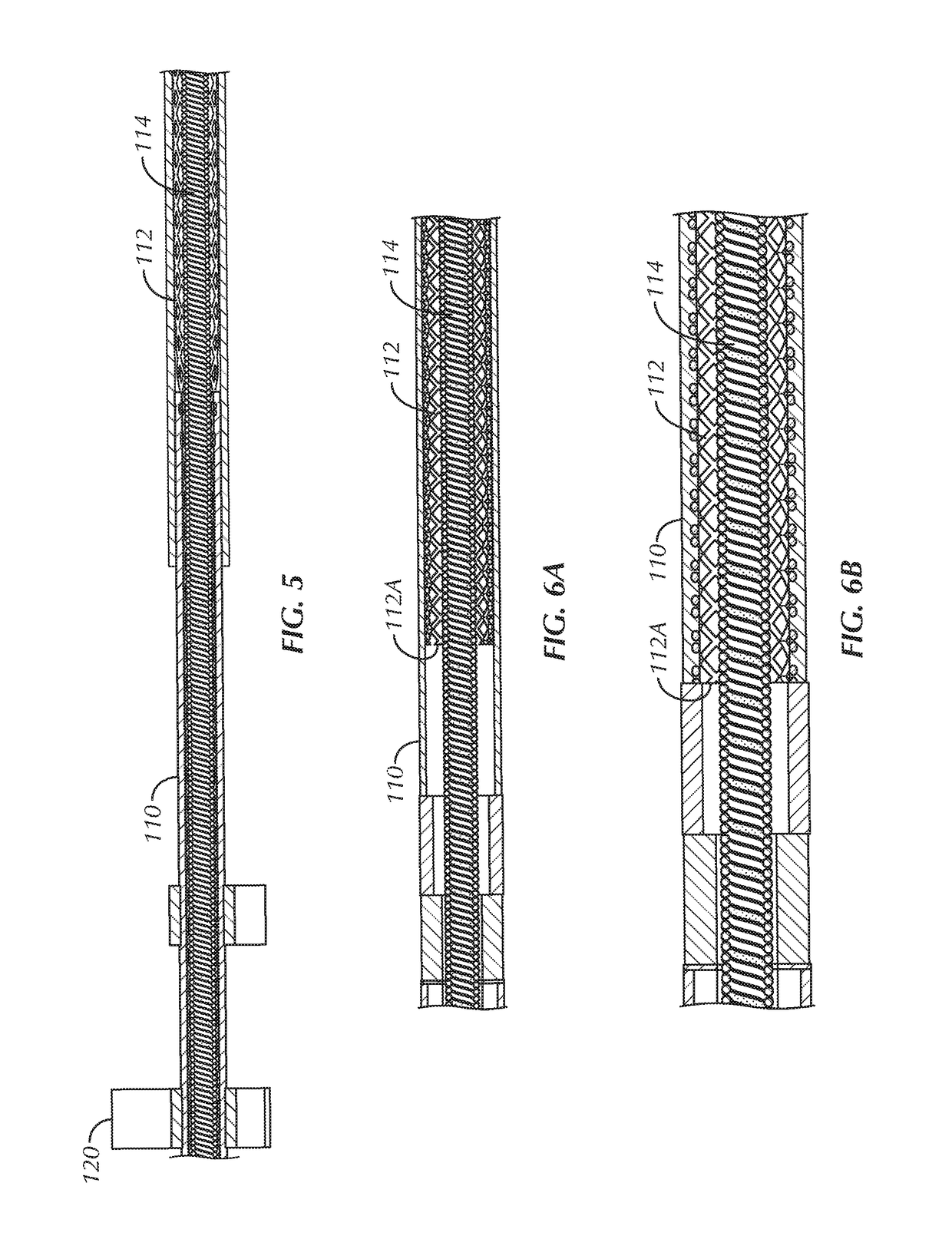 Apparatus with unencapsulated reinforcement