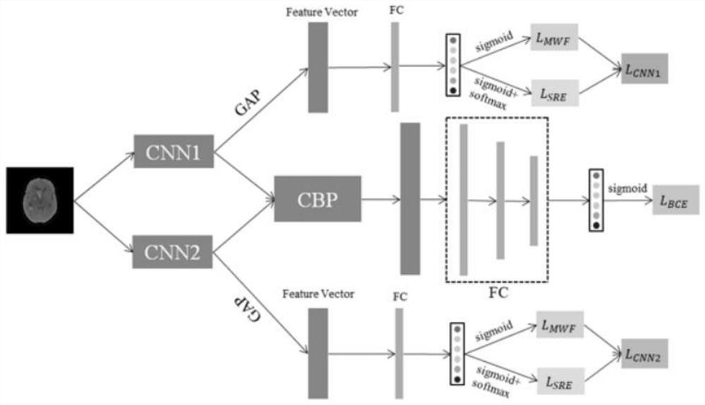 Intracranial hemorrhage sub-type classification algorithm applied to CT image based on bilinear pooling