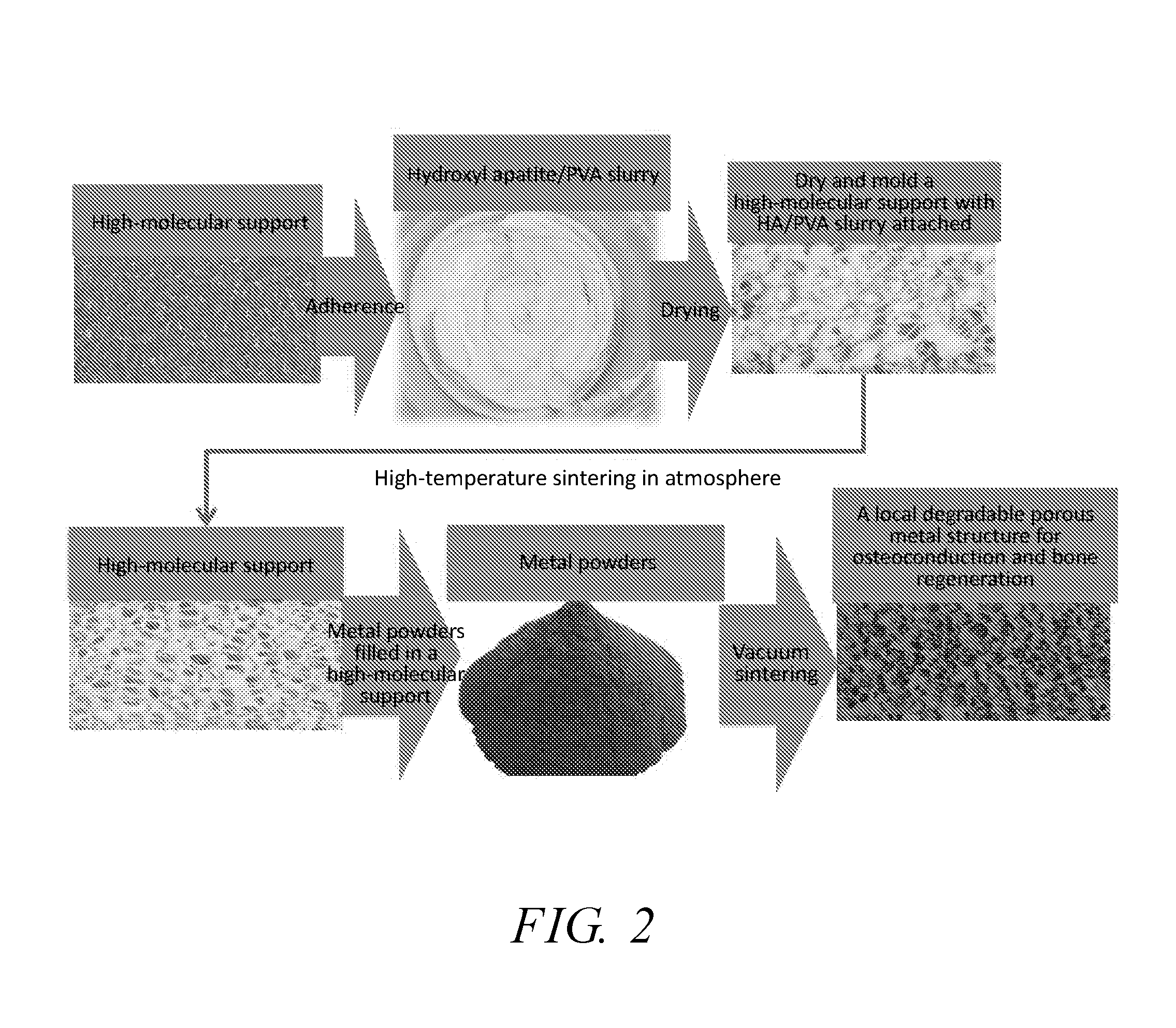 Intervertebral implant