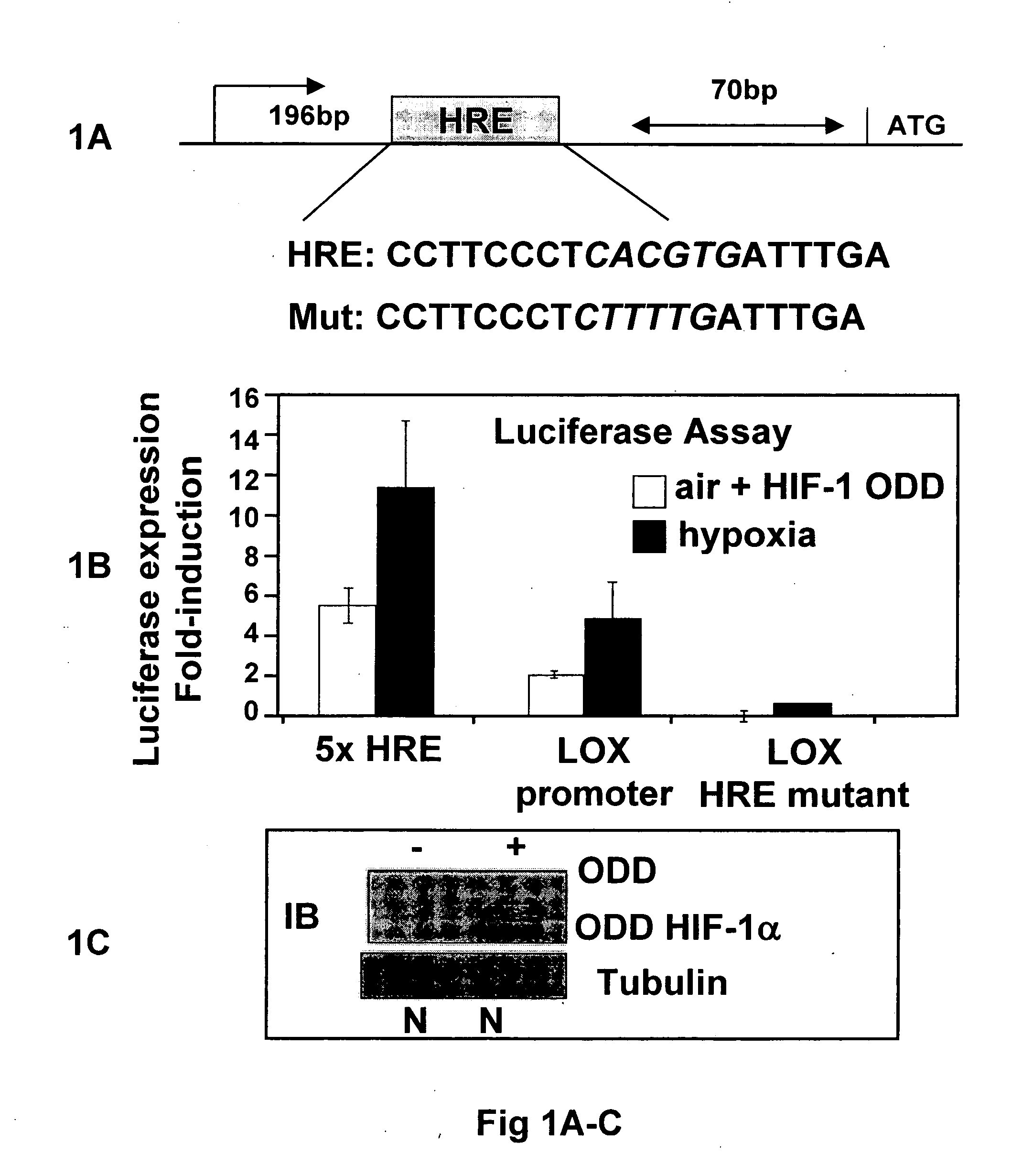 Method and composition for treating and preventing tumor metastasis in vivo