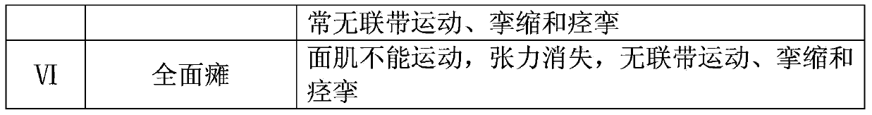 Traditional Chinese medicine composition treating facial neuritis, preparation method and application thereof