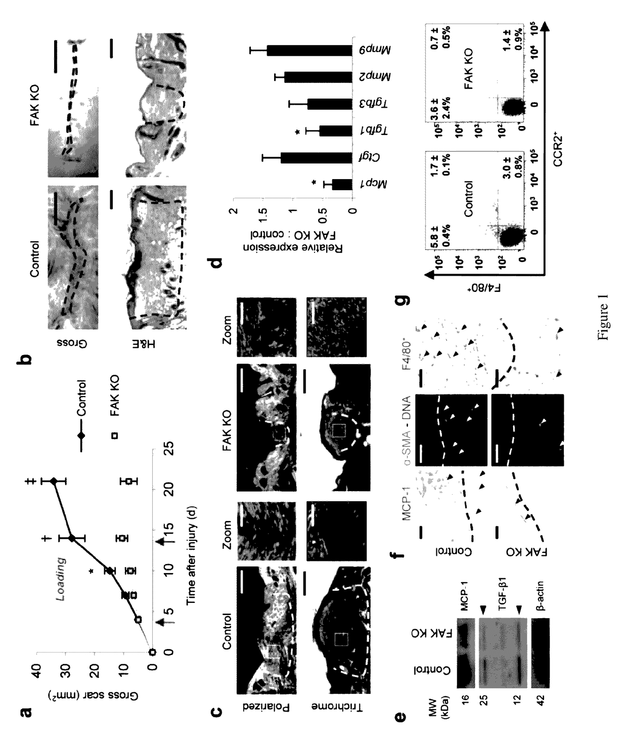 Inhibition of focal adhesion kinase for control of scar tissue formation