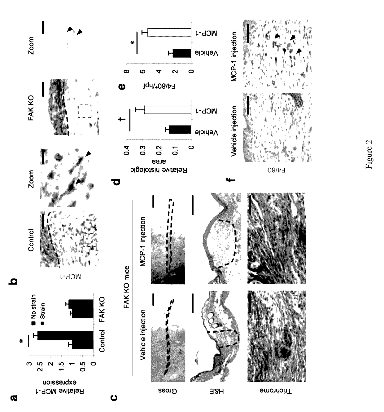 Inhibition of focal adhesion kinase for control of scar tissue formation