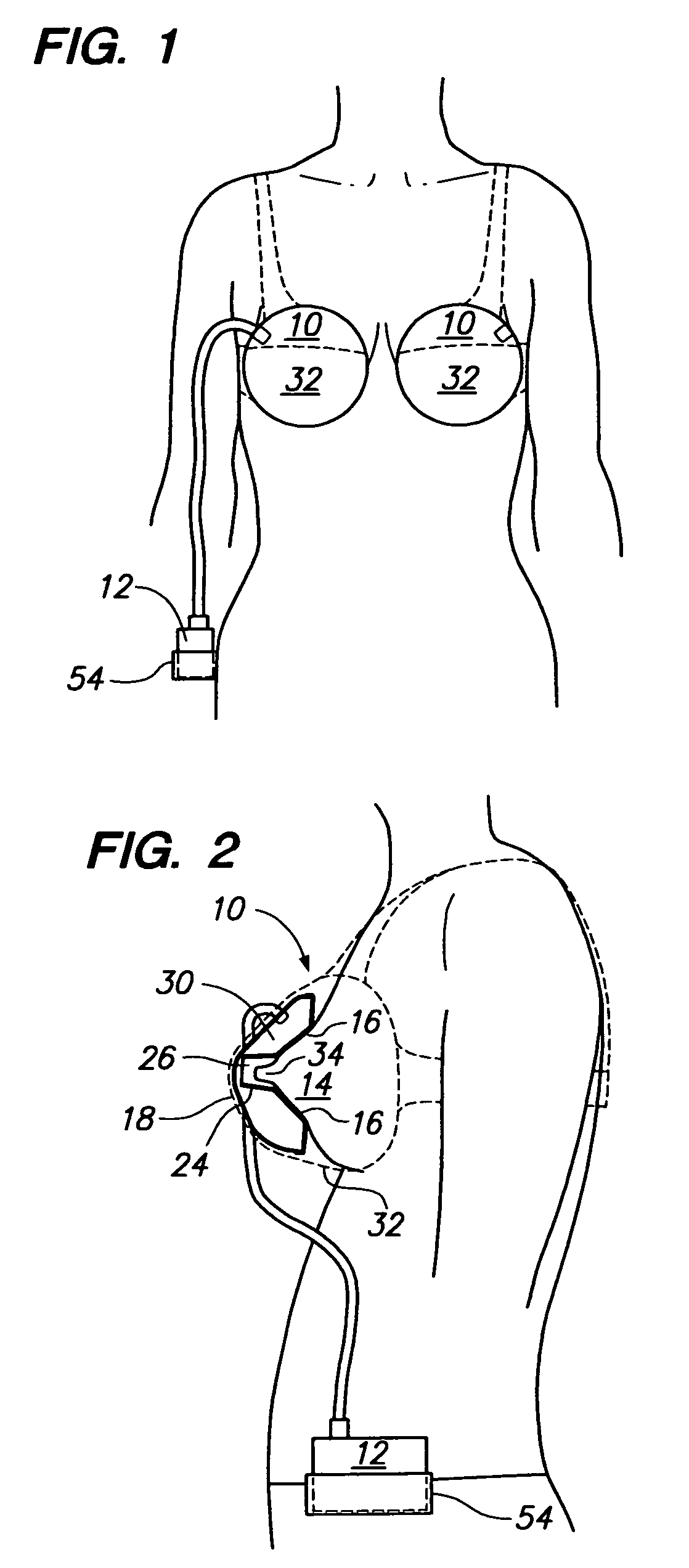 Breast pump device with self-contained breast milk reservoir