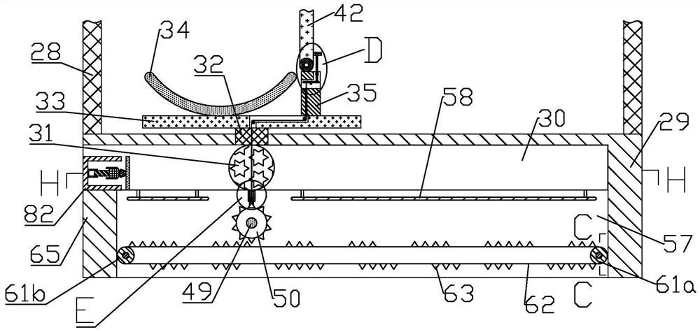 Varicosity postoperative recovery stent for vascular surgery and use method thereof