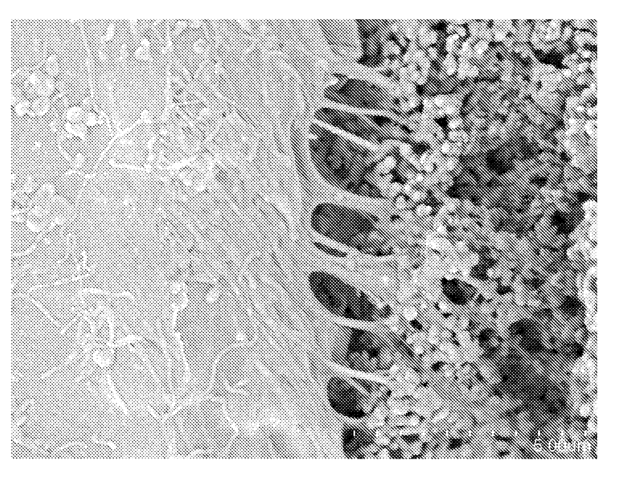 Nanostructured hydroxyapatite coating for dental and orthopedic implants