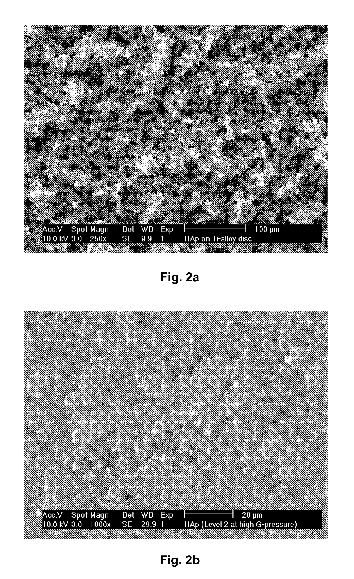 Nanostructured hydroxyapatite coating for dental and orthopedic implants