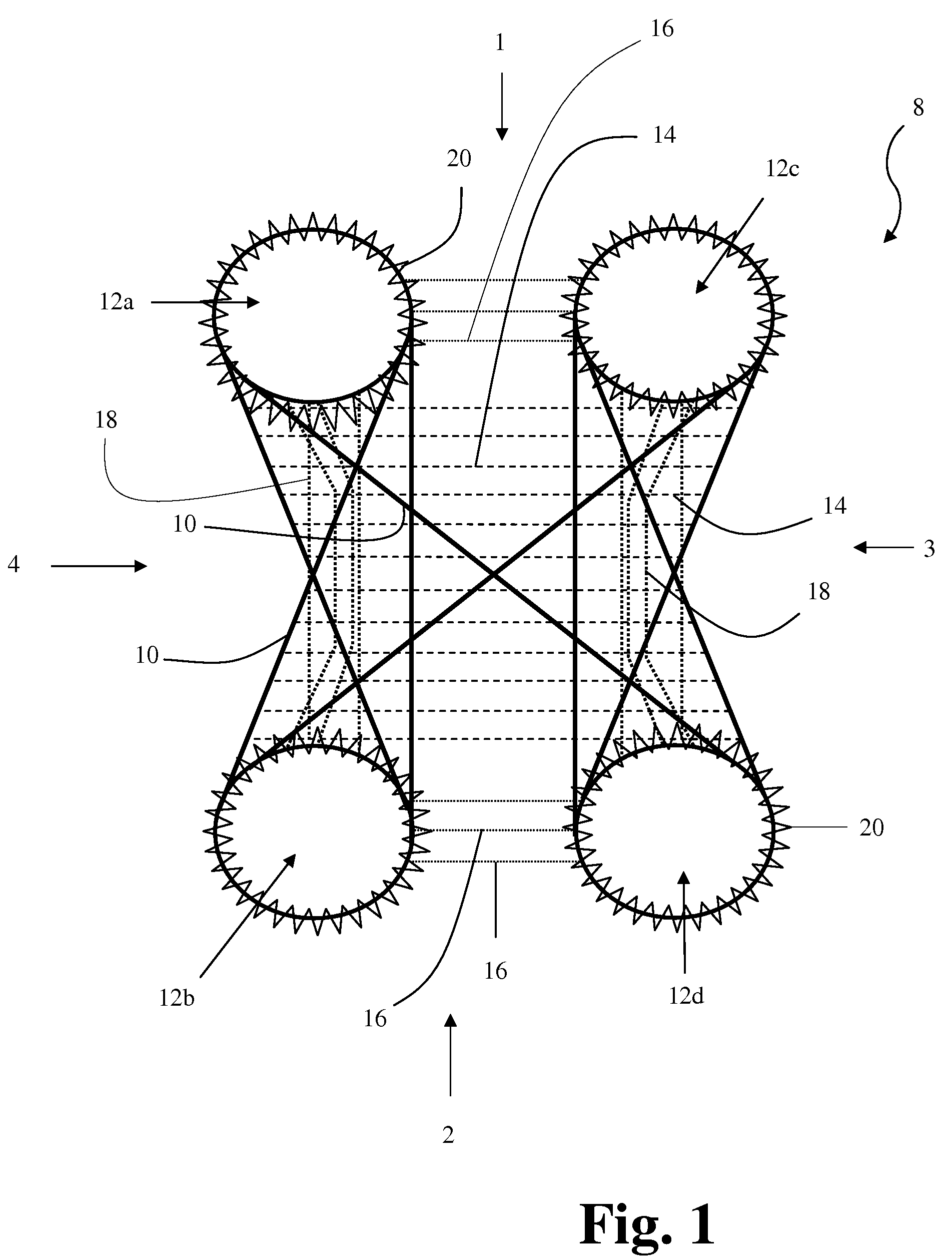 Textile-based plate implant and related methods