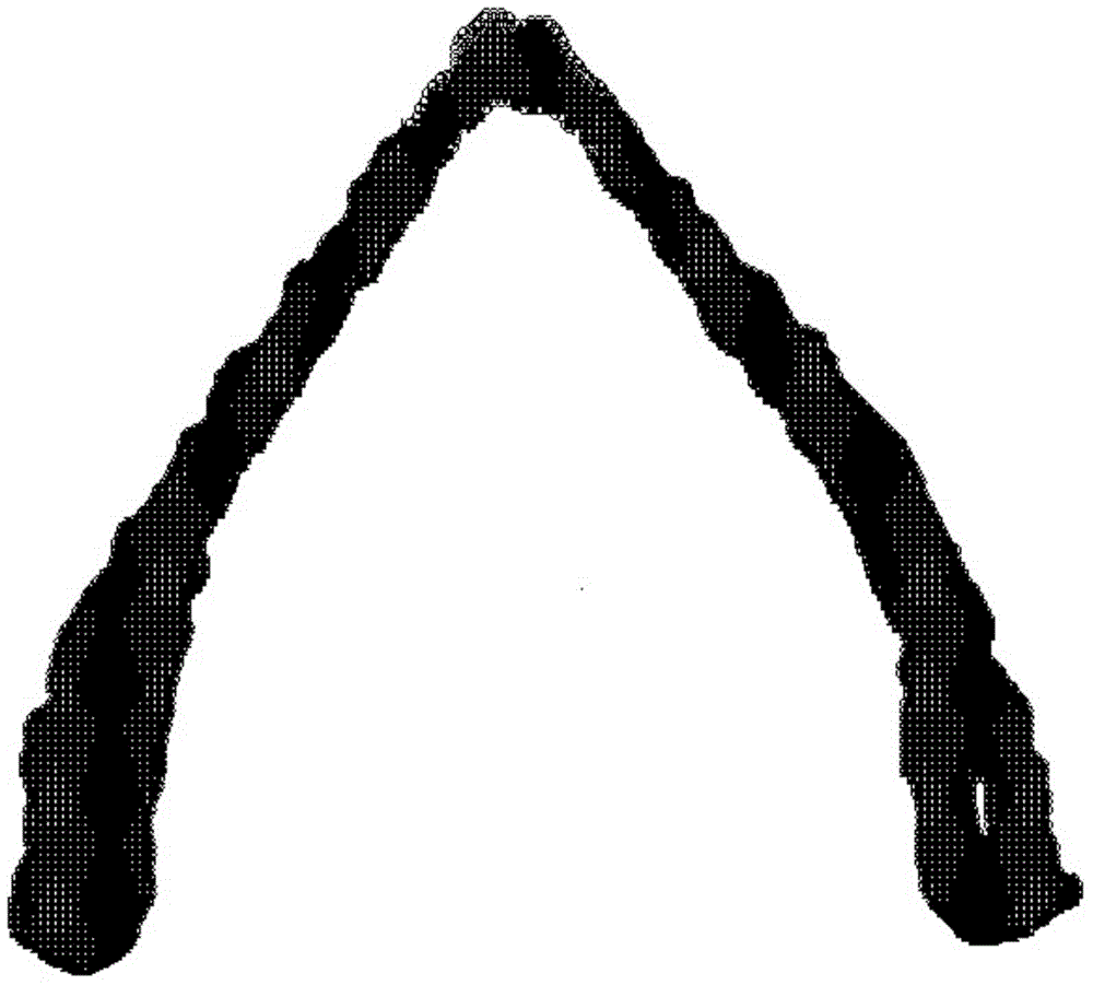 Method for preparing individual porous thyroid cartilage support