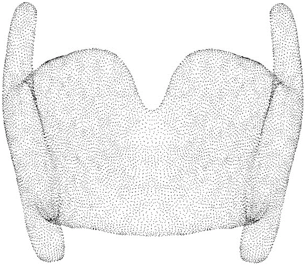 Method for preparing individual porous thyroid cartilage support