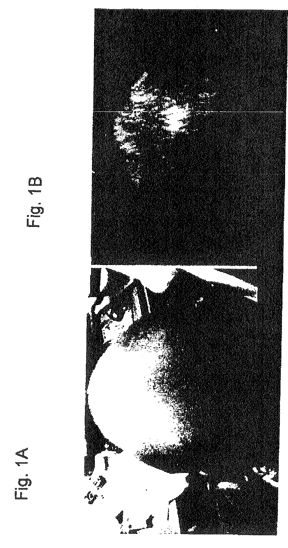 System and method for promoting hair growth and improving hair and scalp health