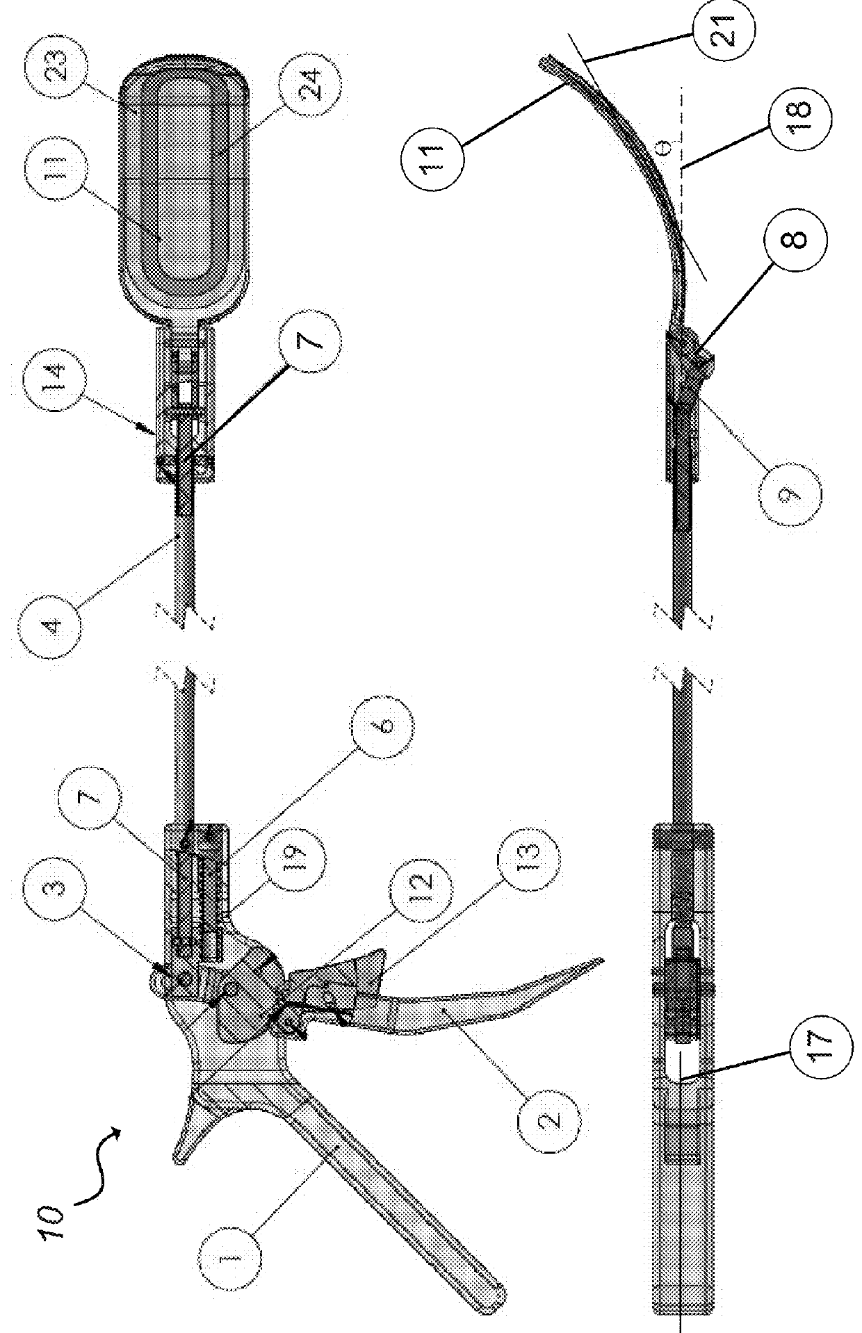 Tissue protecting devices for treatmentof congestive heart failure and other conditions