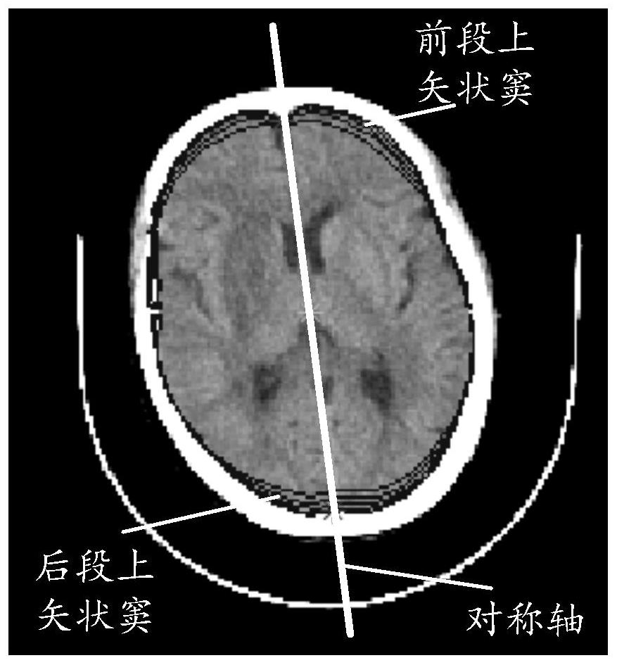 Head symmetry axis identification method and device, storage medium and computer equipment