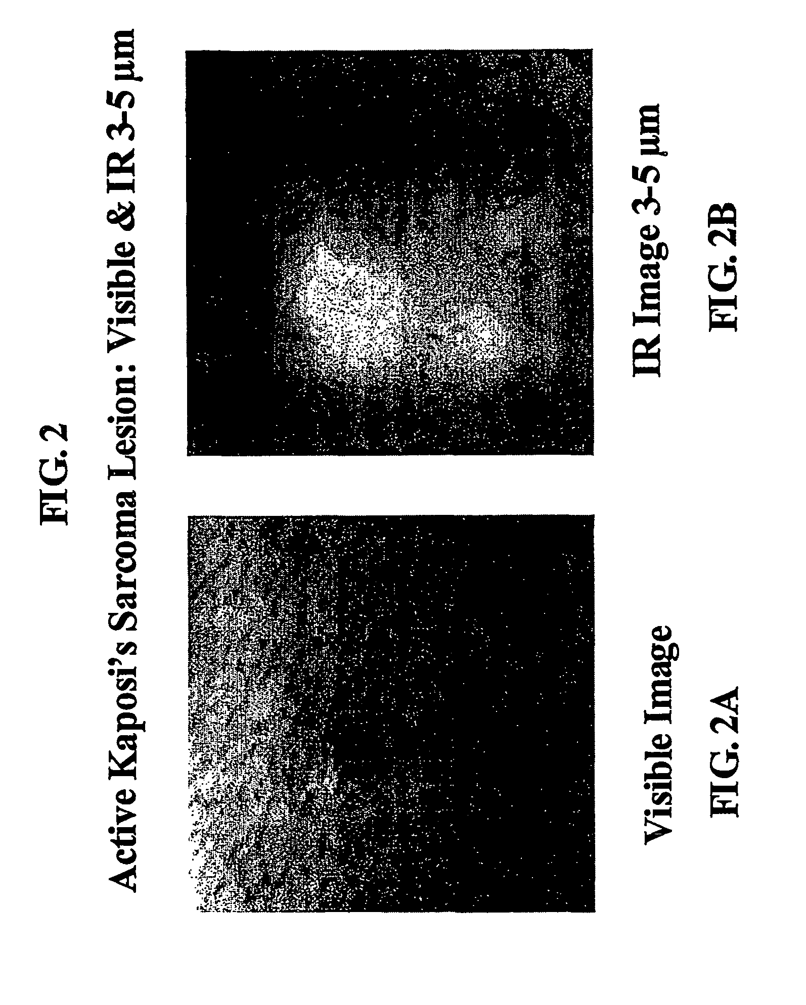 Method for imaging and spectroscopy of tumors and determination of the efficacy of anti-tumor drug therapies