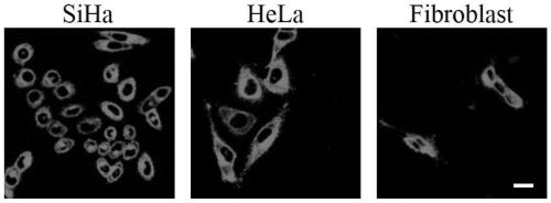 Fluorescent probe for rapidly displaying normal state and near-zero state of potential of cell membrane and application thereof