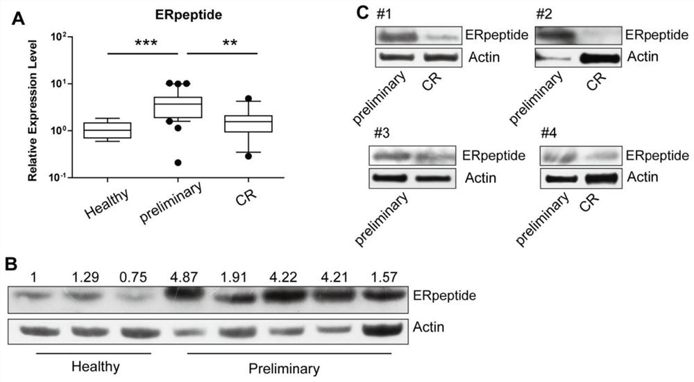 Small peptide ERpeptide and application thereof in acute myeloid leukemia