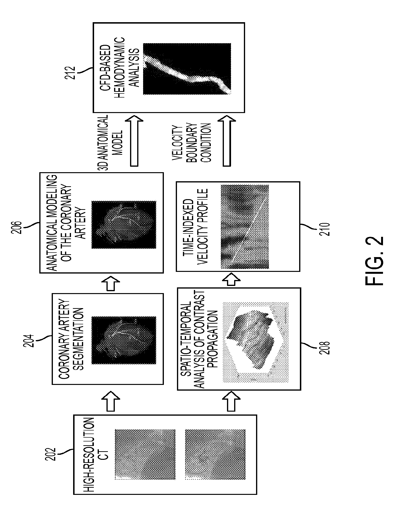 Method and System for Non-Invasive Assessment of Coronary Artery Disease