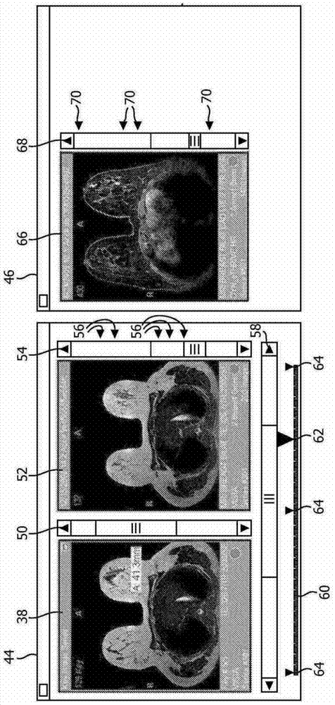 medical image navigation