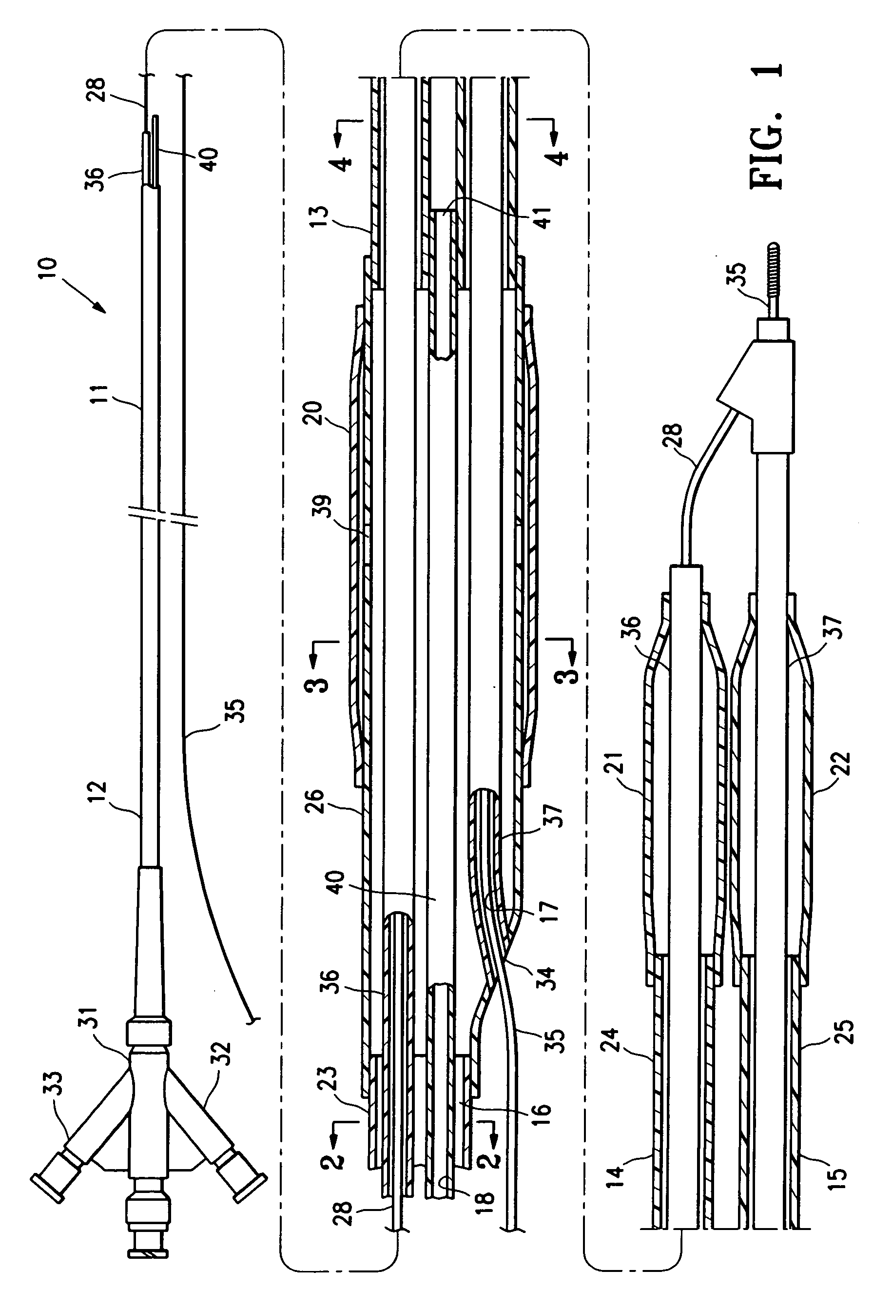 Bifurcated catheter for agent delivery and method of agent delivery