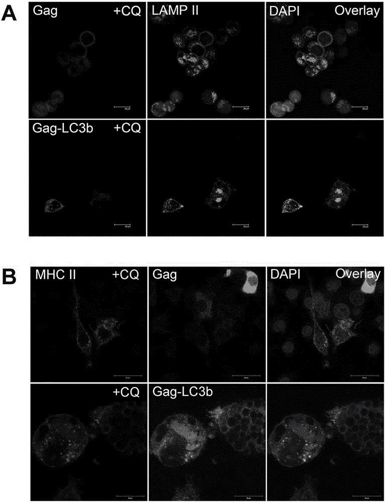 A new HIV vaccine elicits a potent CD4+ T cell immune response