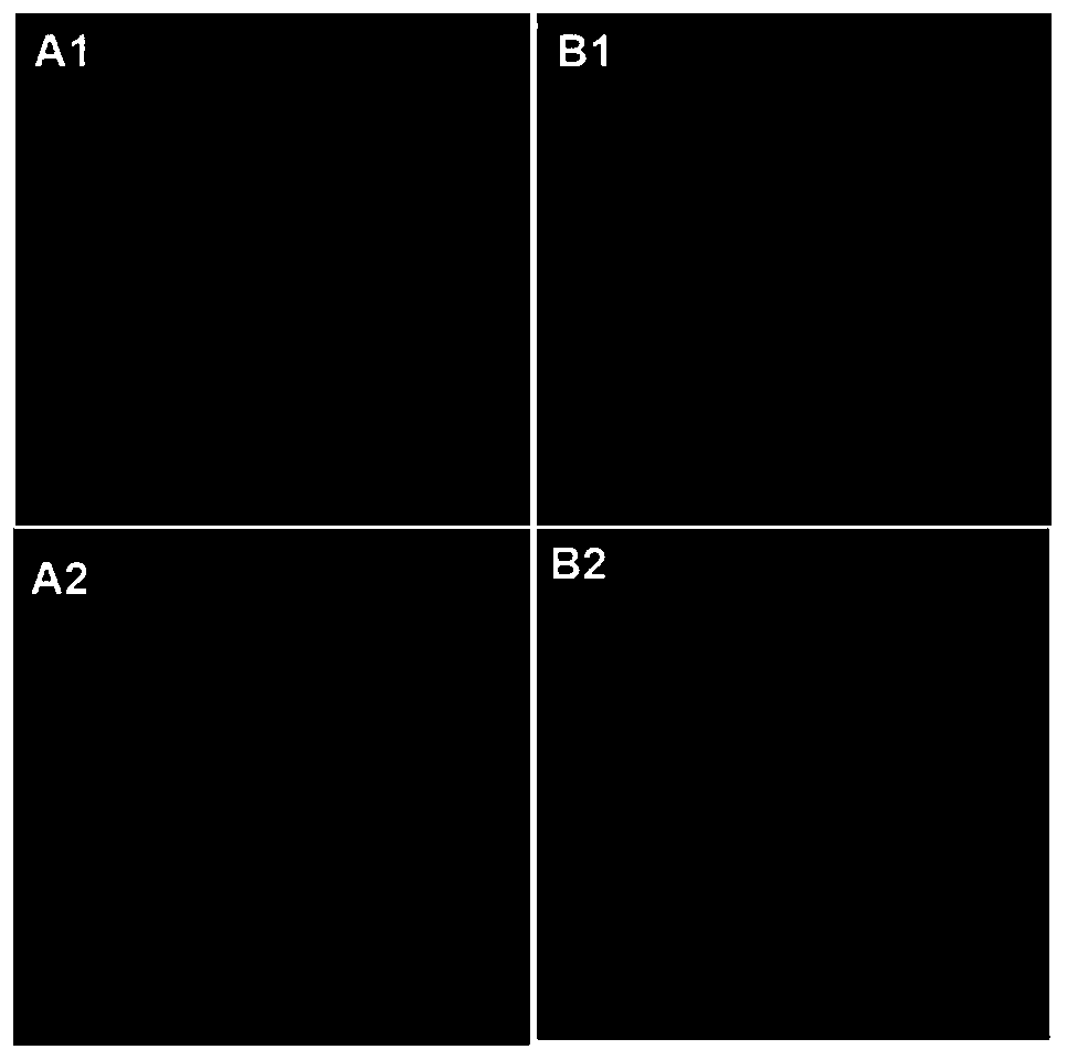 Improved microcarrier living cell fluorescence staining method