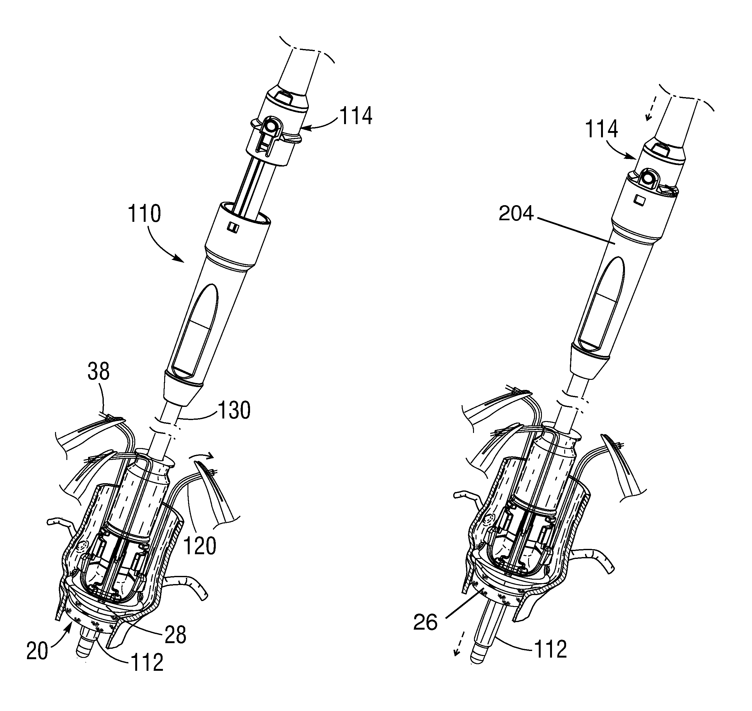 Systems and methods for ensuring safe and rapid deployment of prosthetic heart valves