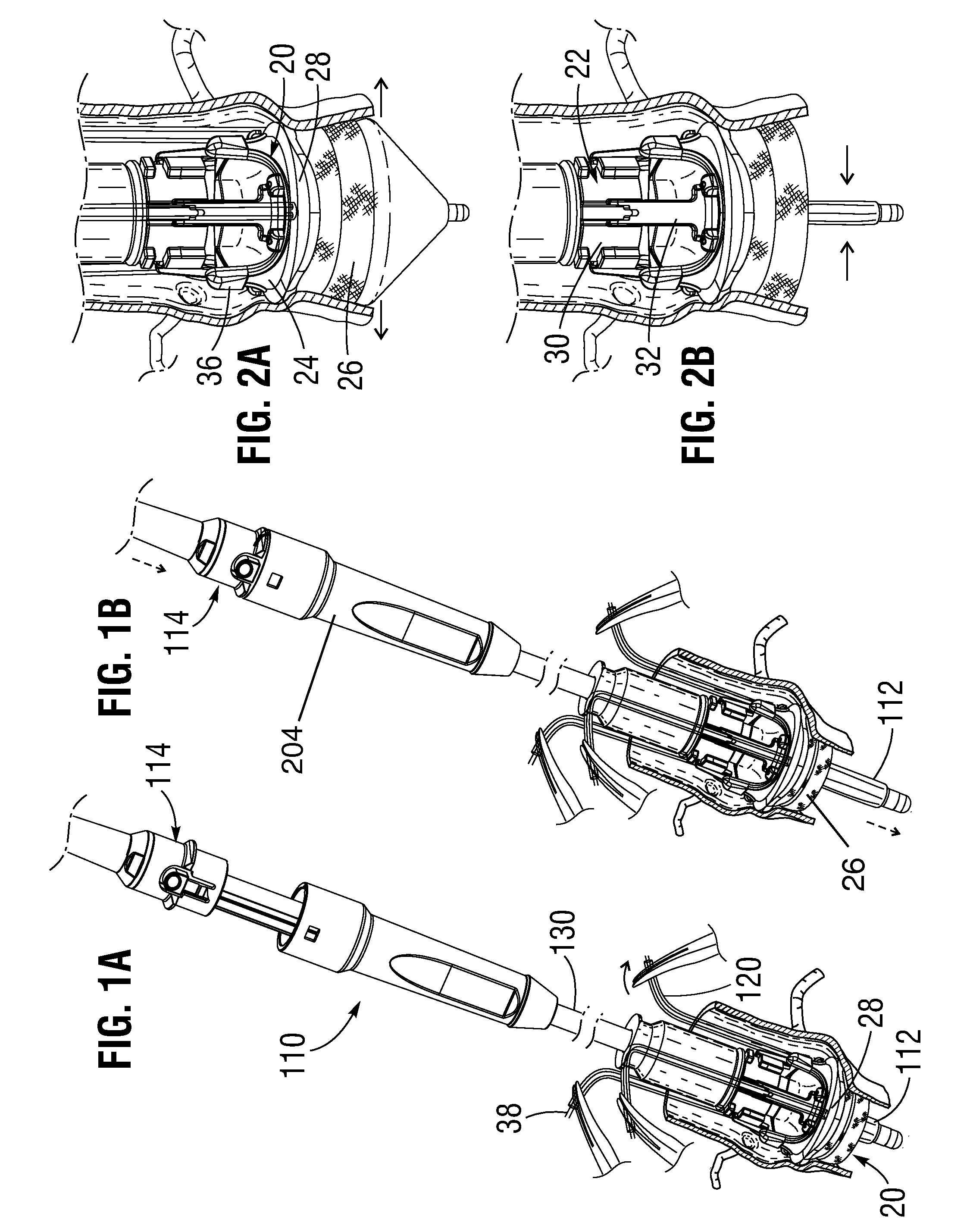 Systems and methods for ensuring safe and rapid deployment of prosthetic heart valves