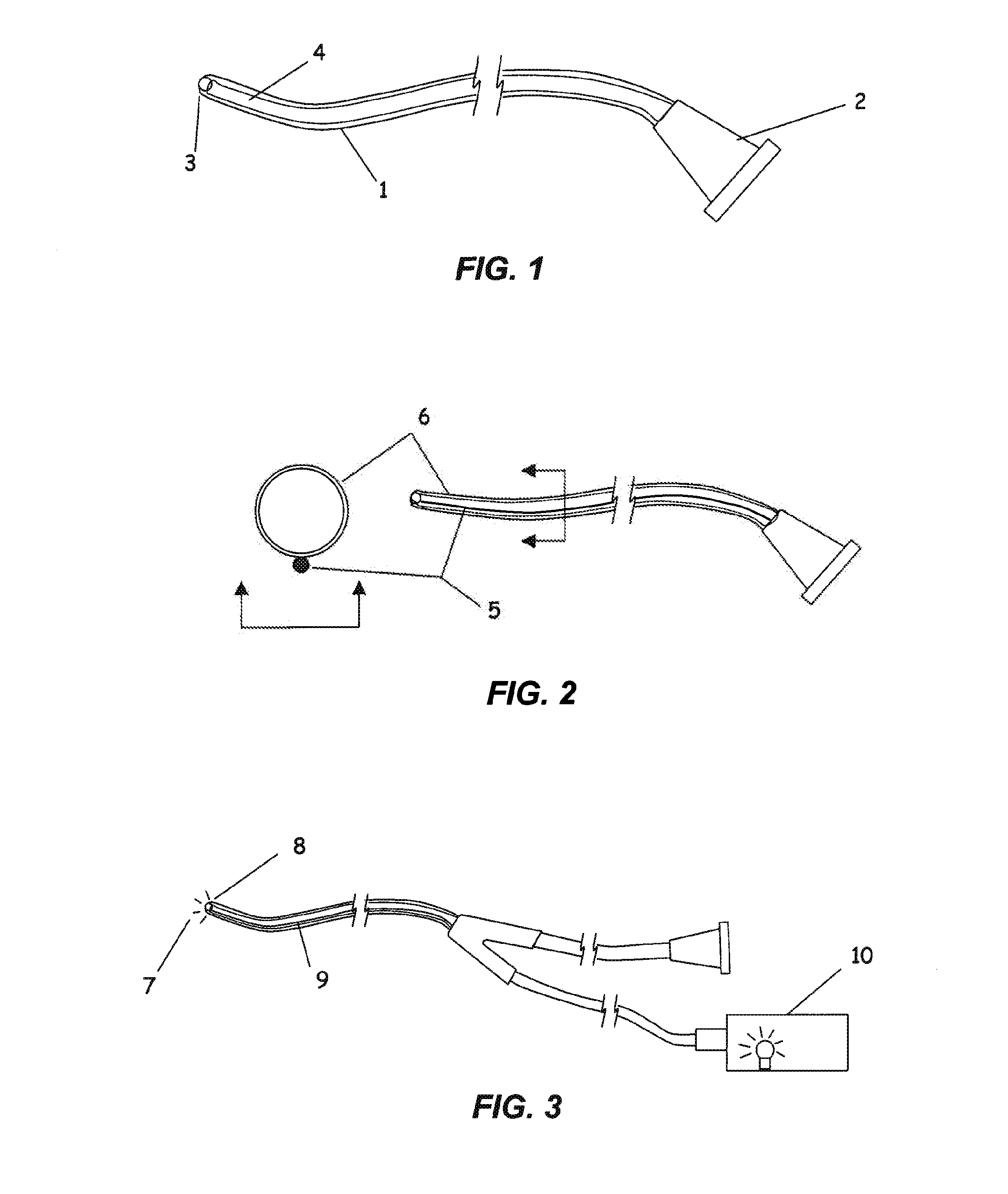 Apparatus and method for ocular treatment