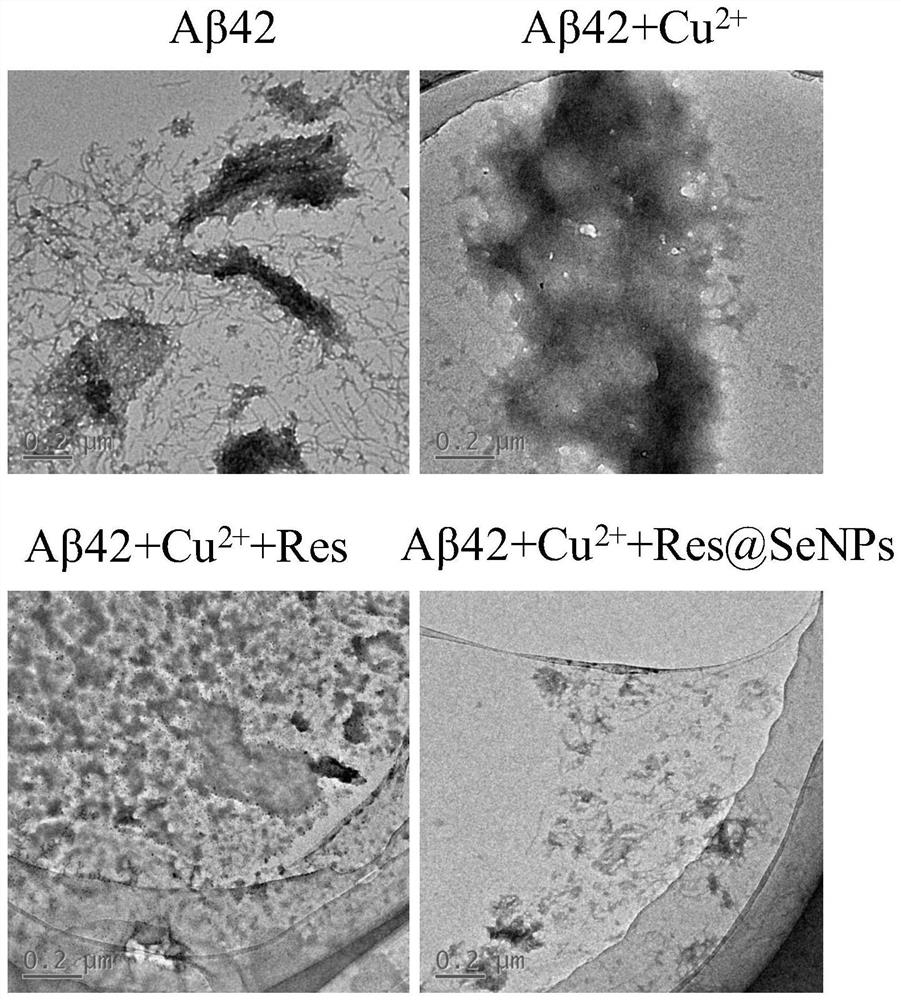 Preparation method and application of nanoparticles capable of inhibiting Aβ polypeptide aggregation and scavenging active oxygen