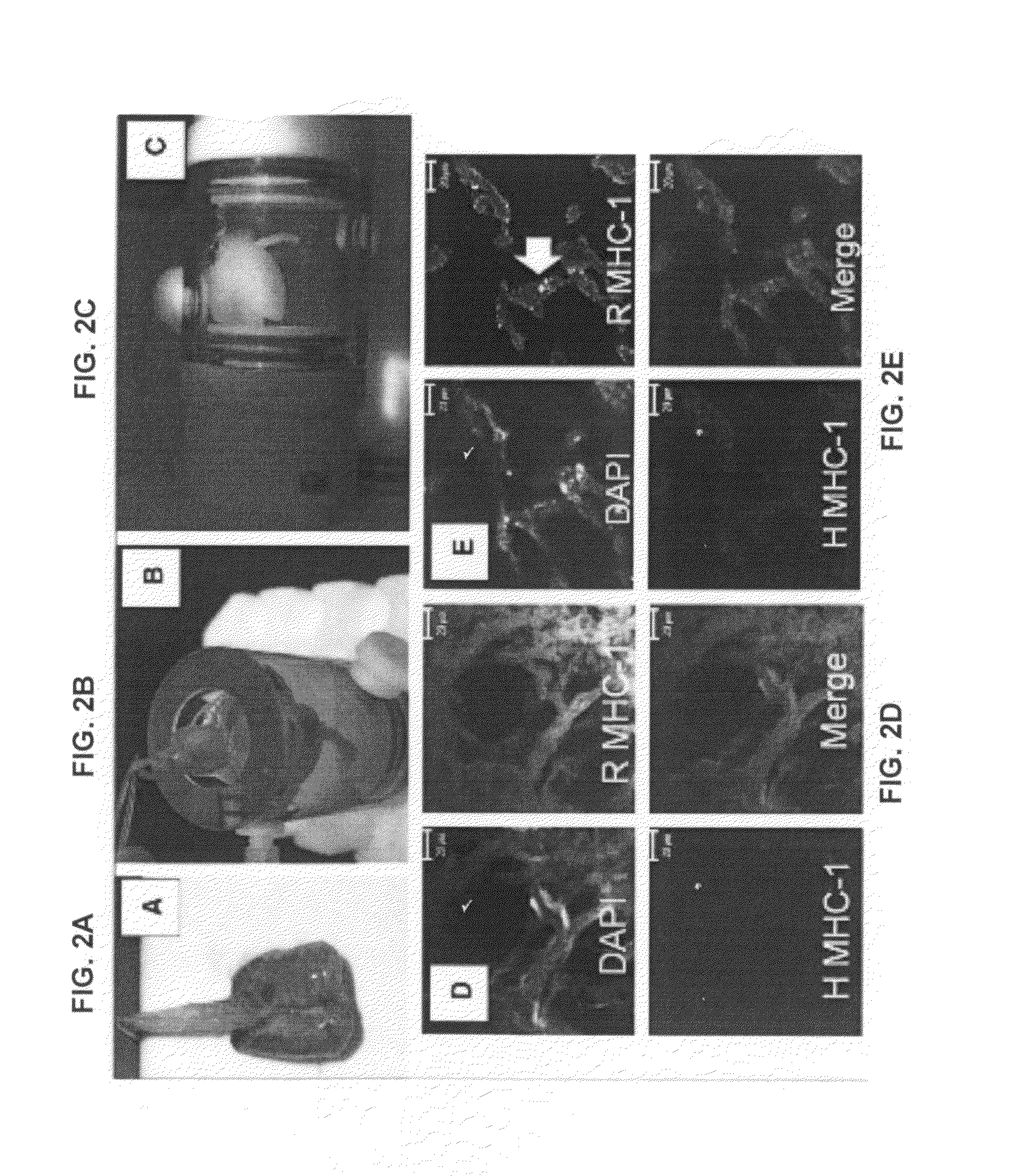 Production of and uses for decellularized lung tissue