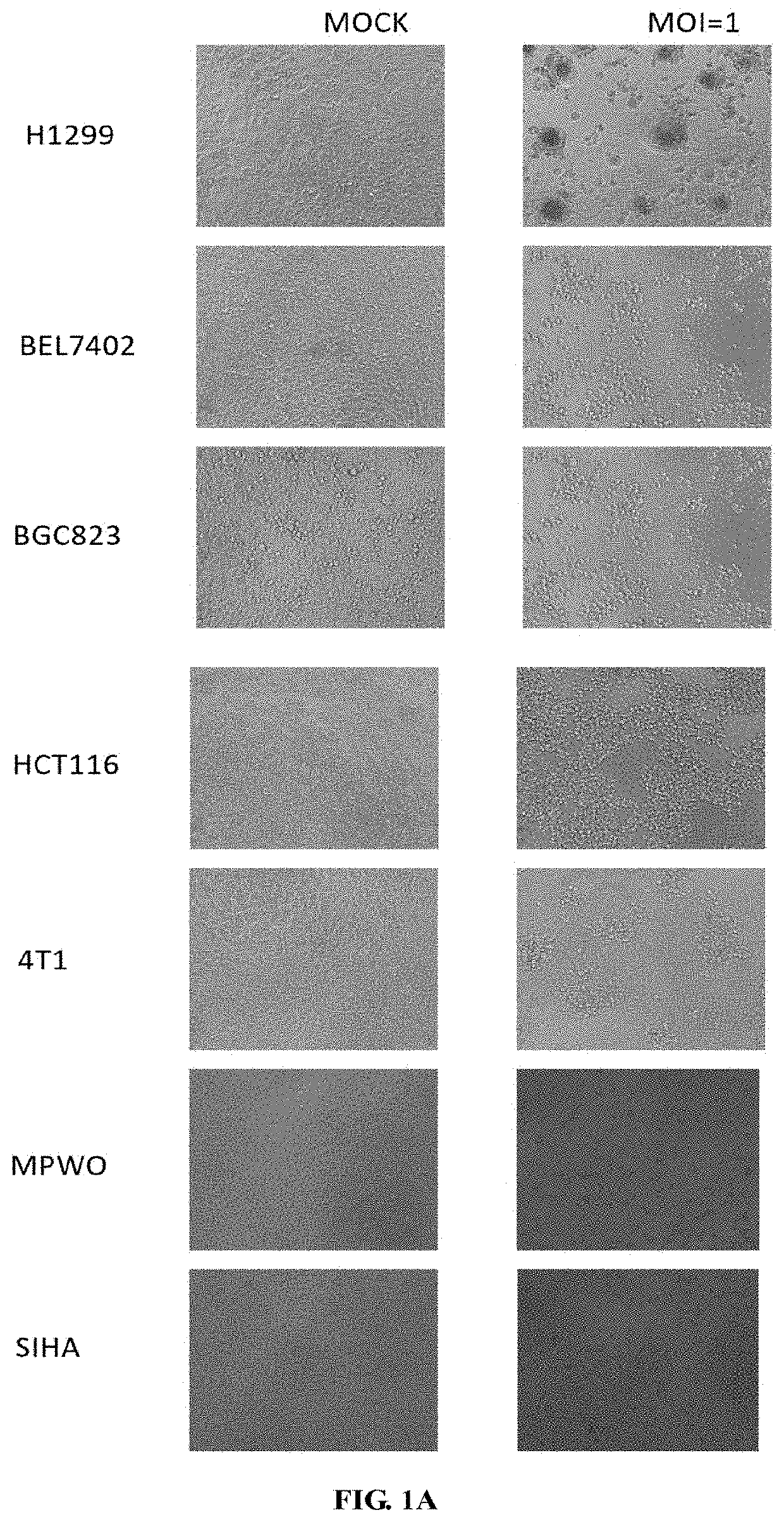 Pseudorabies virus for treating tumors