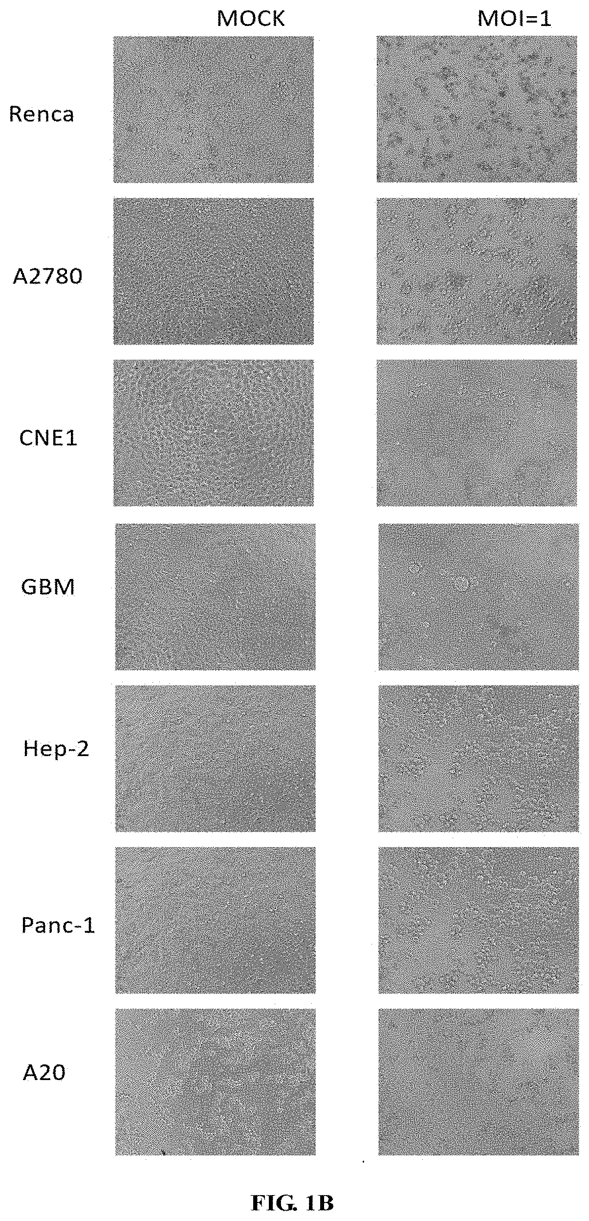 Pseudorabies virus for treating tumors