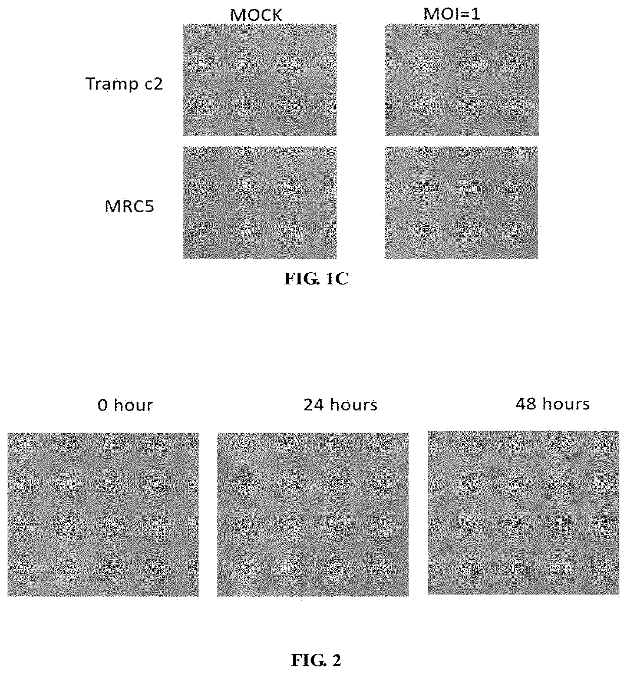 Pseudorabies virus for treating tumors