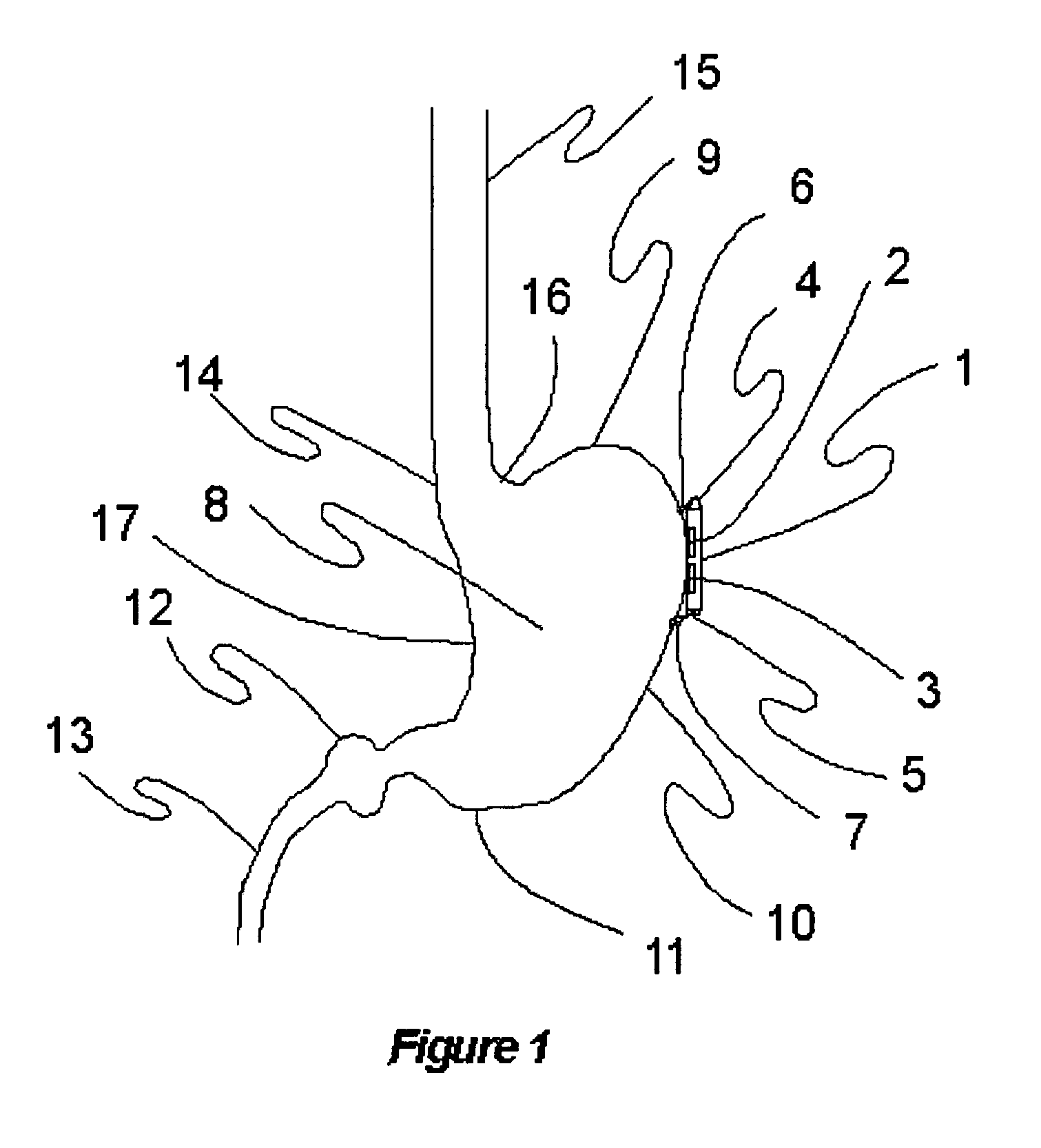 Method and apparatus for neuromodulation and physiologic modulation for the treatment of metabolic and neuropsychiatric disease