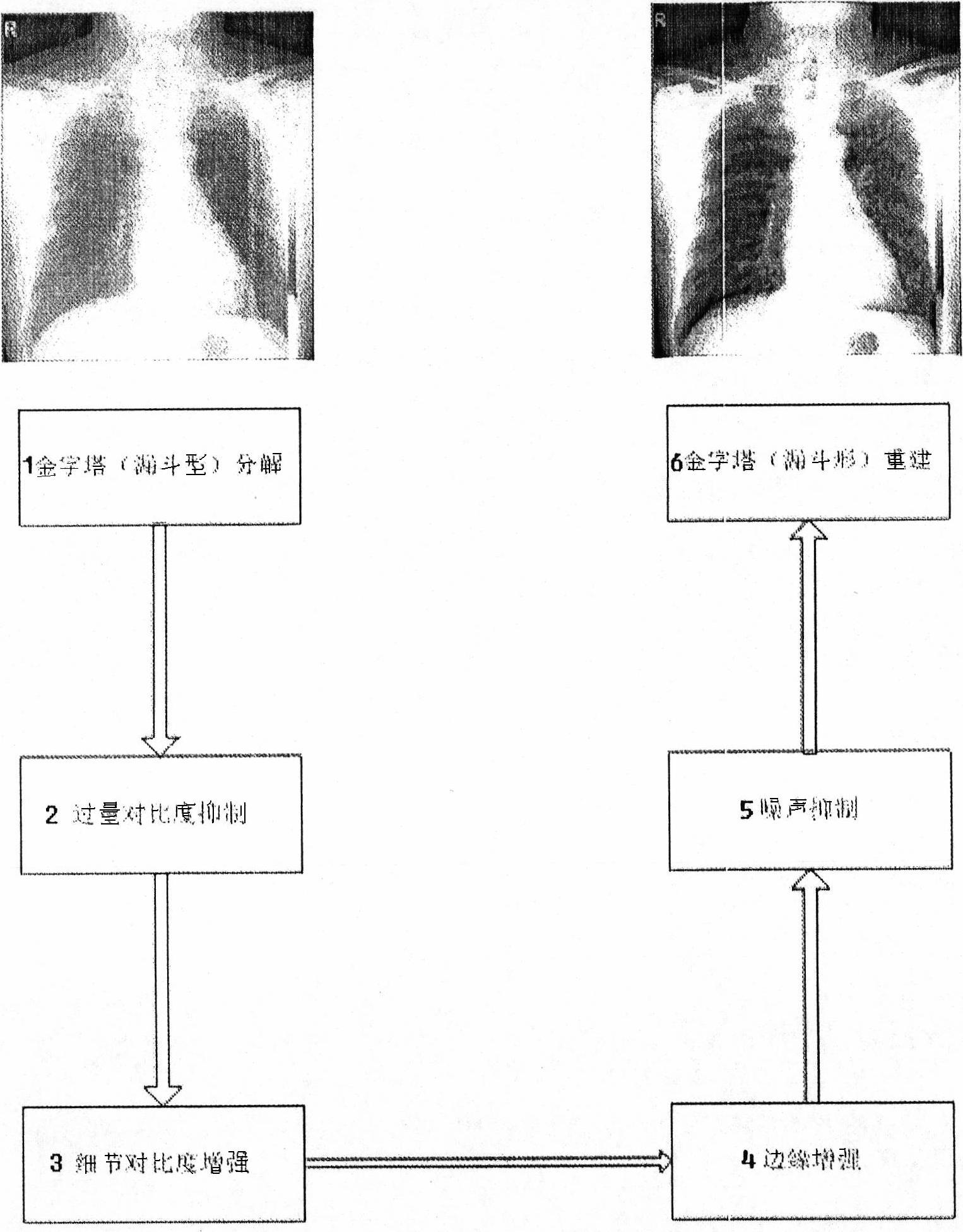 Method for enhancing medical X-ray image display effect