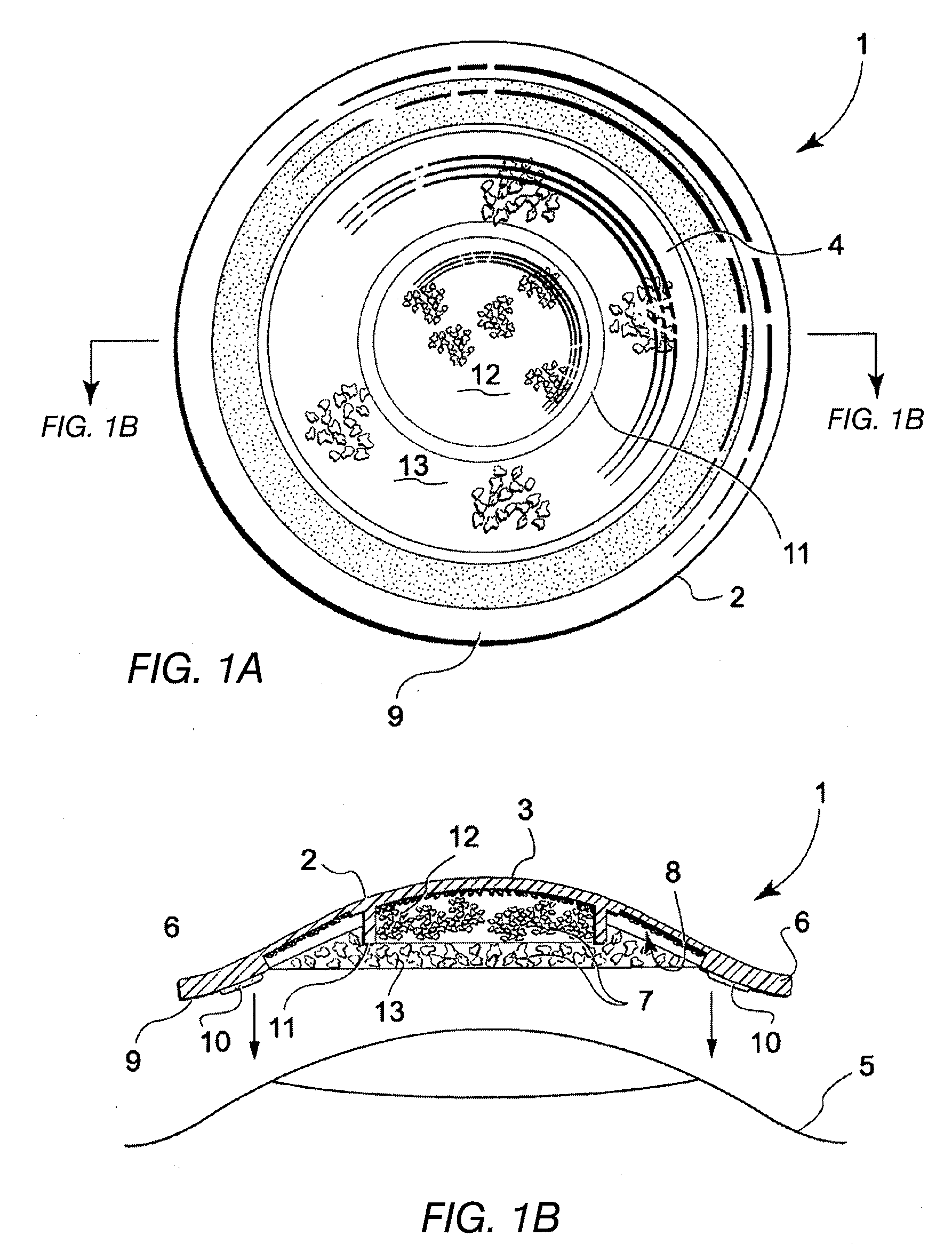 Cultured tissue transplant device