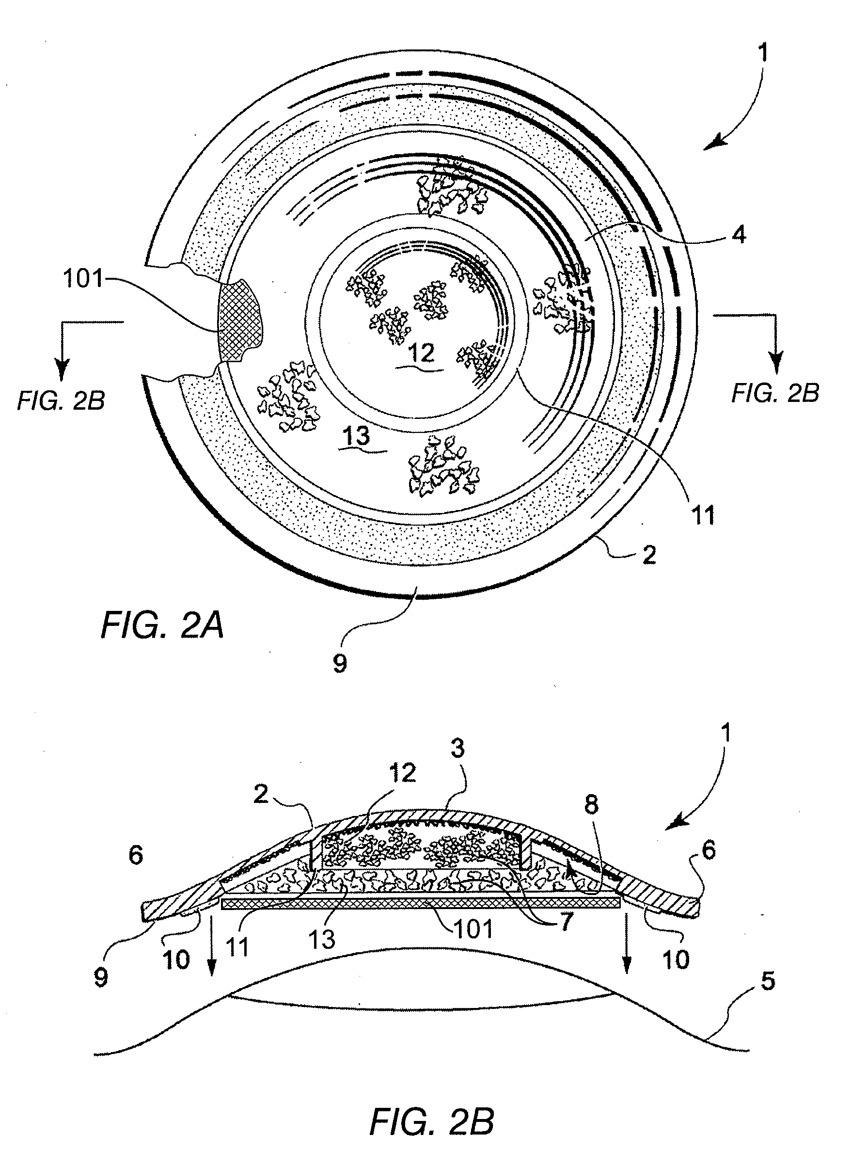 Cultured tissue transplant device