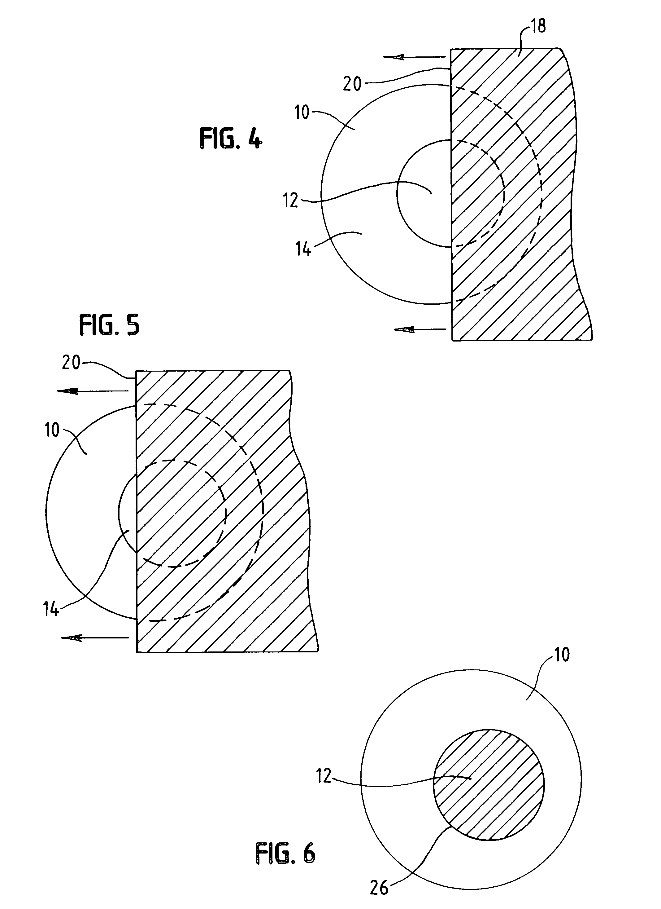 Method and apparatus for correcting off-center laser ablations in refractive surgery